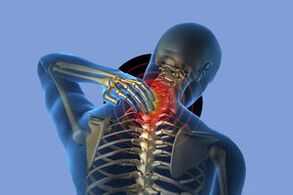 Symptômes d'ostéochondose cervicale