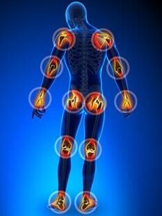 Emplacement des articulations touchées par l'arthrose