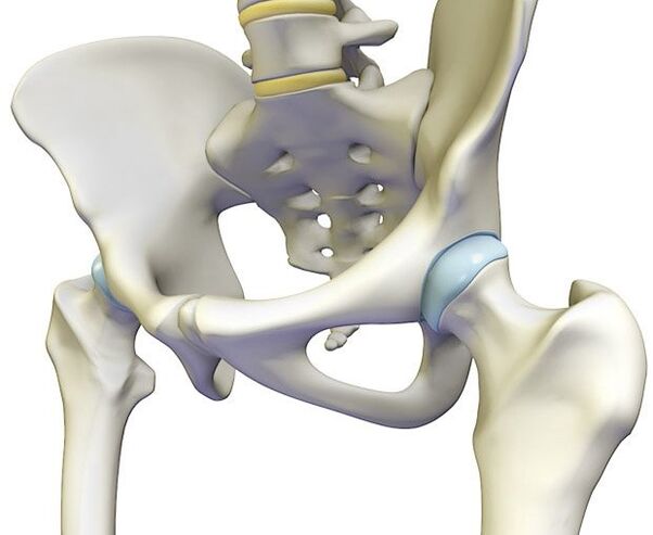 L'ostéochondrose provoque une douleur aiguë dans l'articulation de la hanche. 