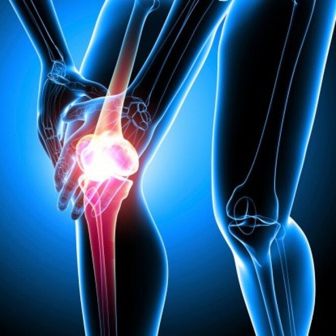 La polyarthrite rhumatoïde à un stade avancé peut causer des douleurs à la hanche